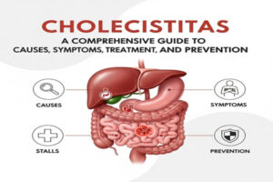 Cholecistitas: A Comprehensive Guide to Causes, Symptoms, Treatment, and Prevention