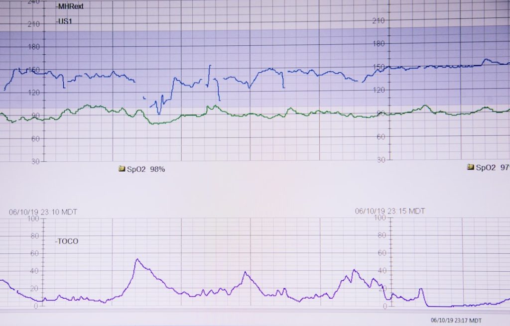 lifeline on white paper model comparison, latency chart, ai cost, performance testing